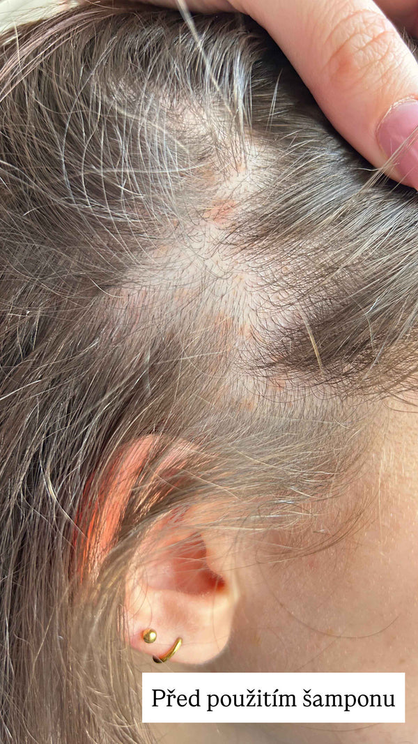 Officina Naturae Šampon pro velmi citlivou pokožku Ultra Delicato (250 ml)