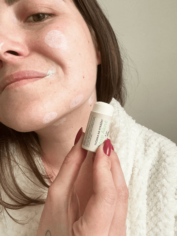 Kvitok SOS Zinková tyčinka na pupínky a opary (6 ml)